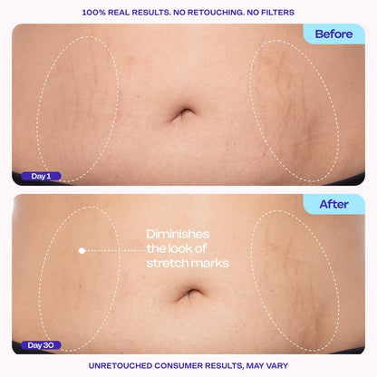 New! GOPURE Tighten & Smooth Belly Firming Cream
